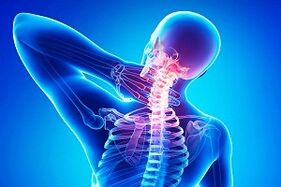 sakit punggung sebagai gejala osteochondrosis