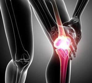 nyeri lutut pada arthritis dan arthrosis