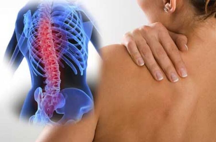 Selama eksaserbasi osteochondrosis tulang belakang toraks, nyeri dorsago terjadi
