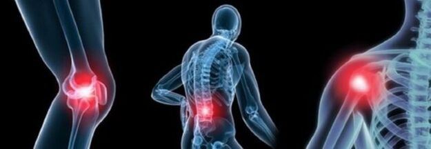 Jenis Nyeri dengan Arthrosis