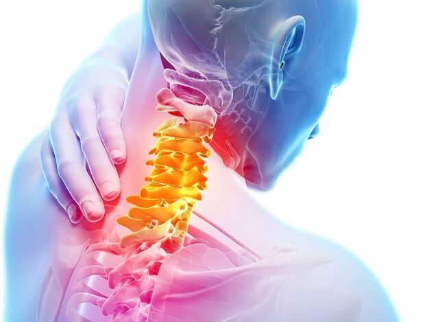 Gejala dan tahap perkembangan osteokondrosis serviks