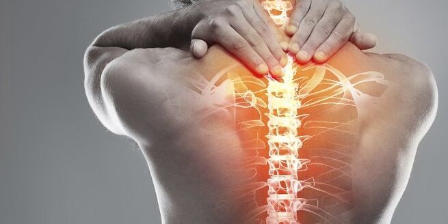 Pilihan medis untuk terapi serviks osteokondrosis serviks