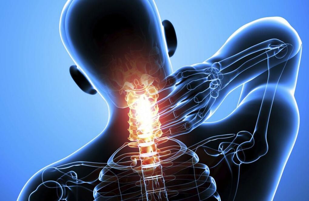 Osteochondrosis pada tulang belakang leher