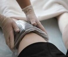 aplikasi ozokerite pada lutut untuk arthrosis
