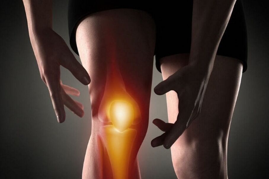 Dengan arthrosis, rasa sakit menjadi lebih kuat saat bergerak
