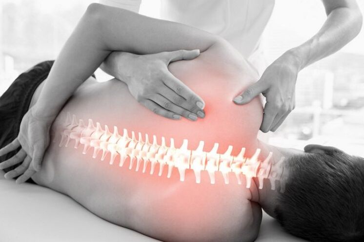 Sesi terapi manual untuk osteochondrosis tulang belakang dada